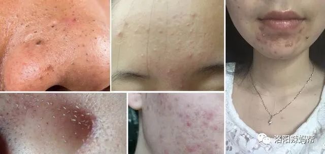 寶媽想掙錢有什么門路,適合寶媽在家用手機做的兼職,寶媽想掙錢