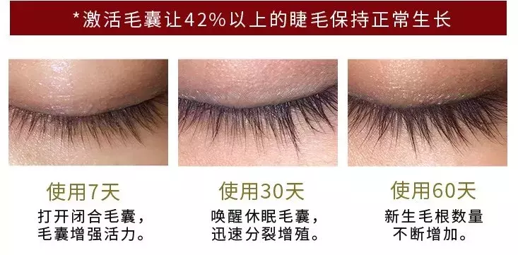 網上睫毛生長液有用嗎,gracelash睫毛增長液怎樣,睫毛生長液有用嗎